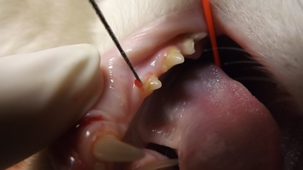 RLPM3 with periodontal probe