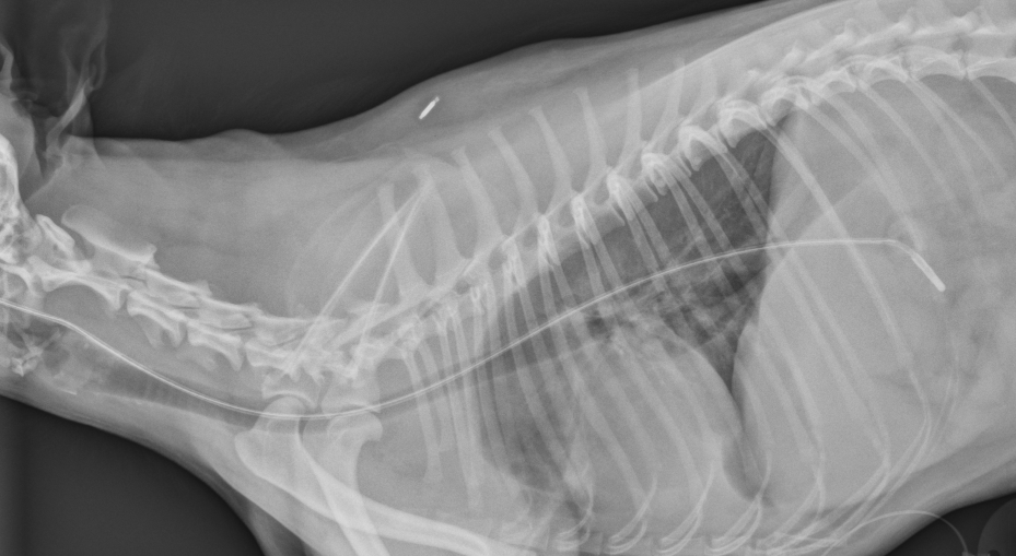 This images shows a lateral chest radiograph confirming proper placement of tube.