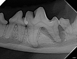 Radiograph left lower molar